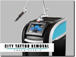 http://citytattooremoval.com/picosure-tattoo-removal website