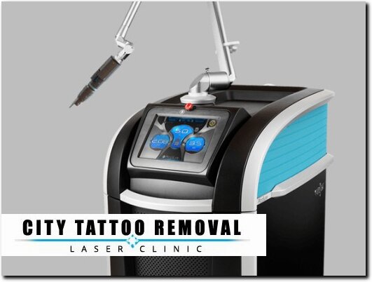 http://citytattooremoval.com/picosure-tattoo-removal website